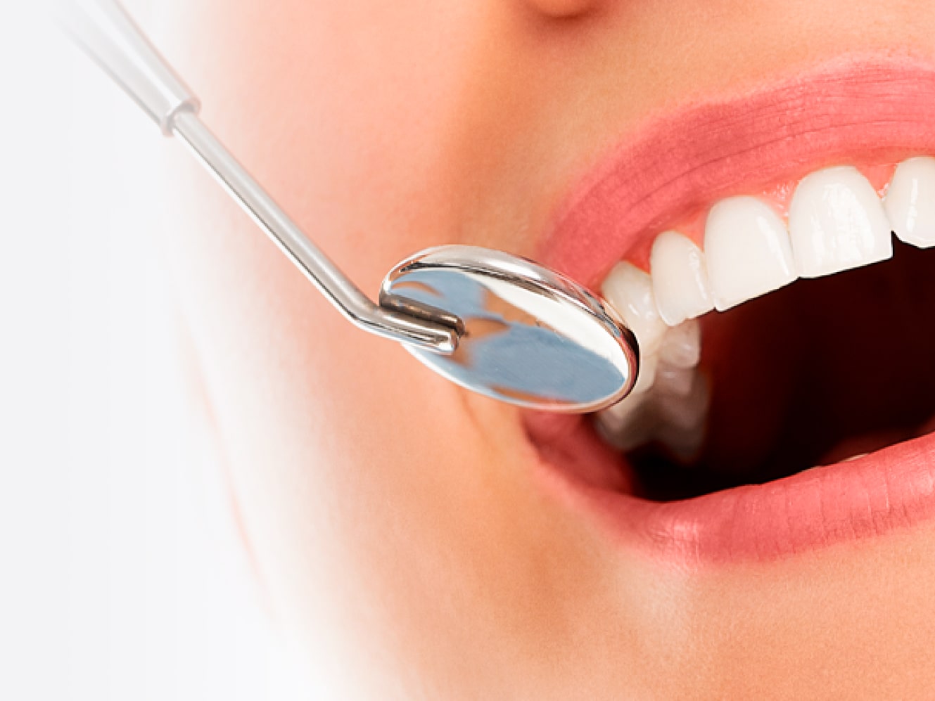 Лечение кариеса