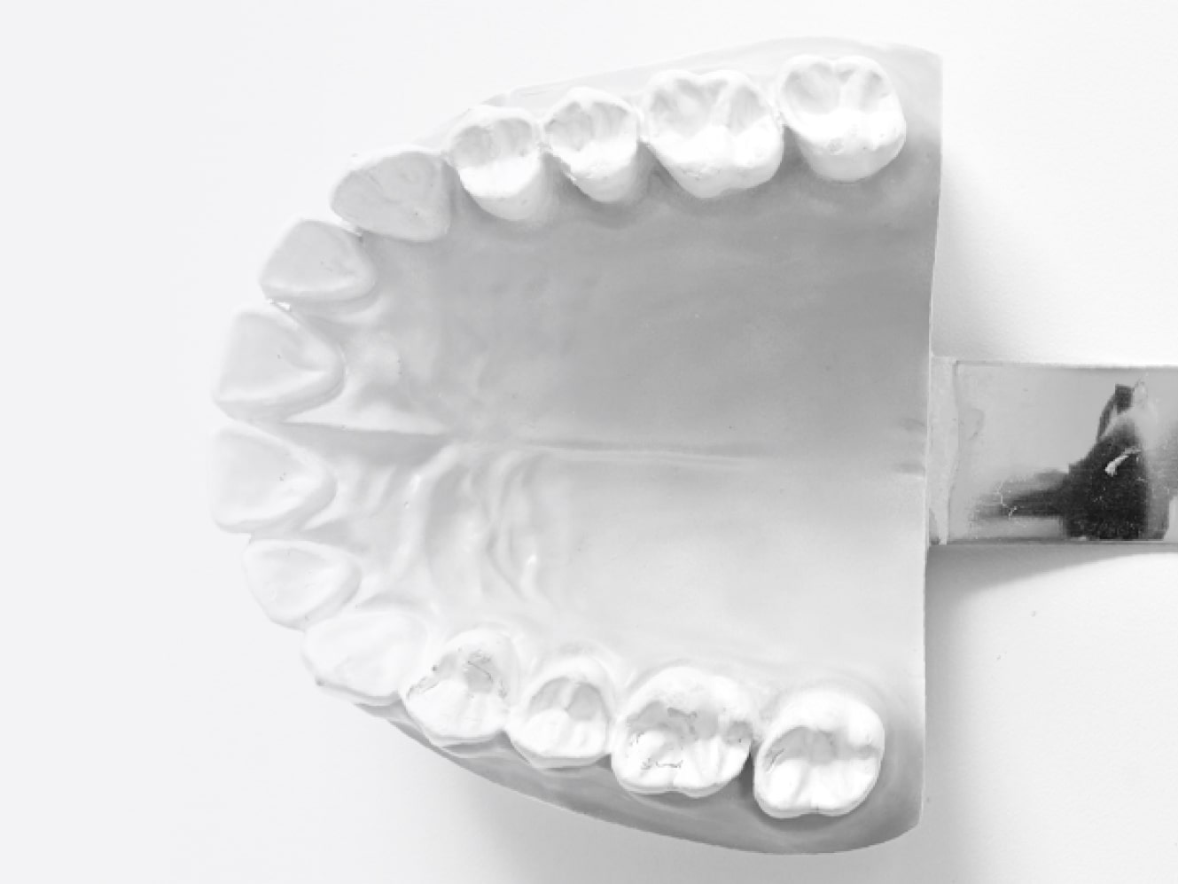 Протезирование зубов